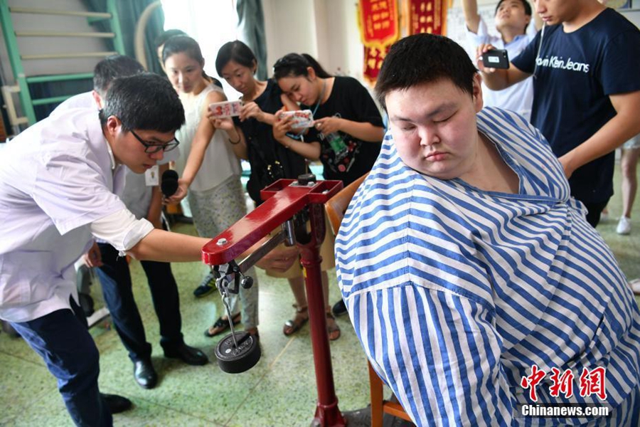 China's heaviest man in hospital weight loss victory