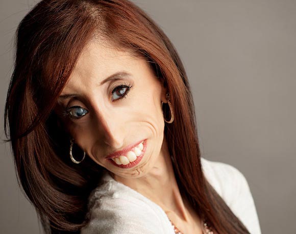 'World's ugliest woman' wants to make anti-bullying film