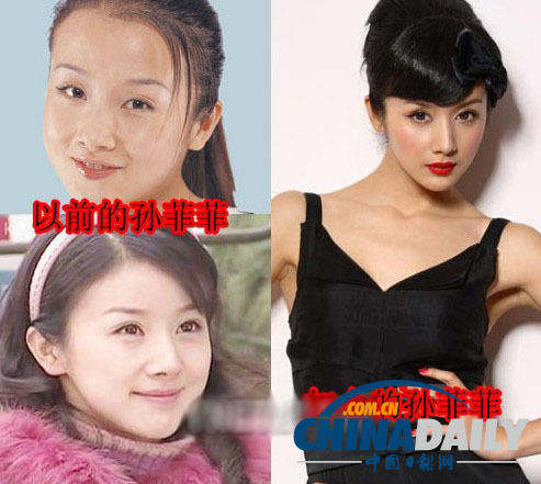 柳巖李小璐楊冪 女星整容前驚人對比照