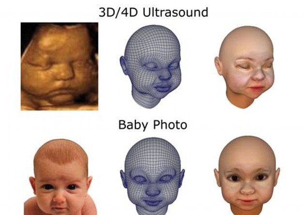 3D打印帶你見未出生胎兒！體位表情皮膚性別皆可見