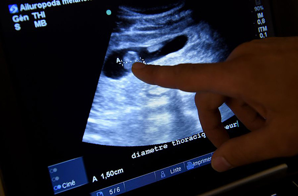 Giant panda in French zoo pregnant